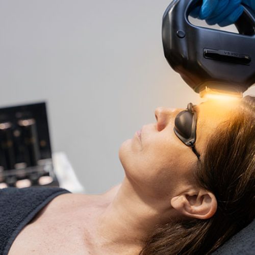 fhos facial